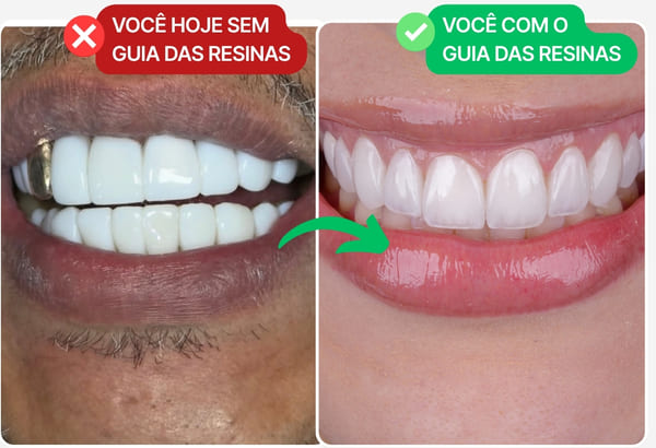 Visual de apresentação do Protocolo Anti-Erro